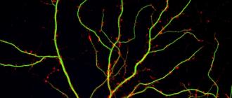 Нервные клетки (Нейроны) Нейрон нервная клетка